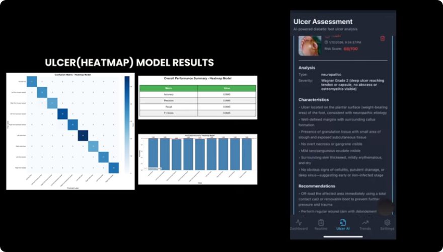 App screen showing an ulcer assessment result
